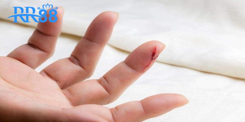 Mơ thấy chảy máu báo hiệu điều gì?